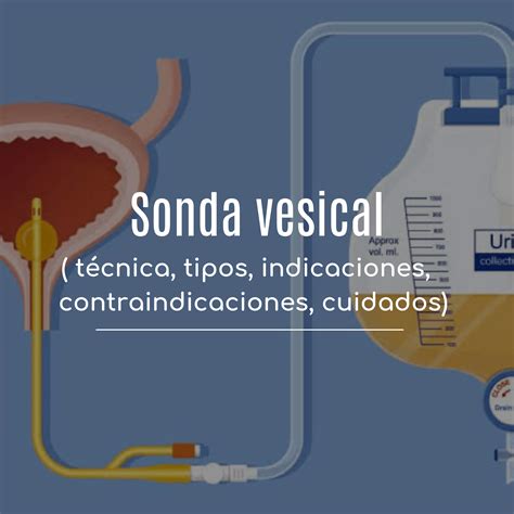 Procedimiento de sondaje vesical. Mujeres